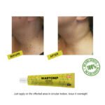 Wartonip Ointment (25gm) - Image 2